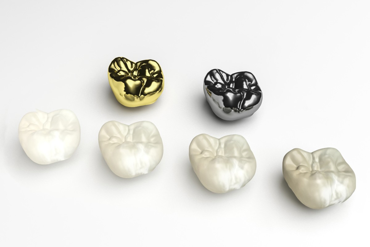 the benefits of dental crowns what you need to know