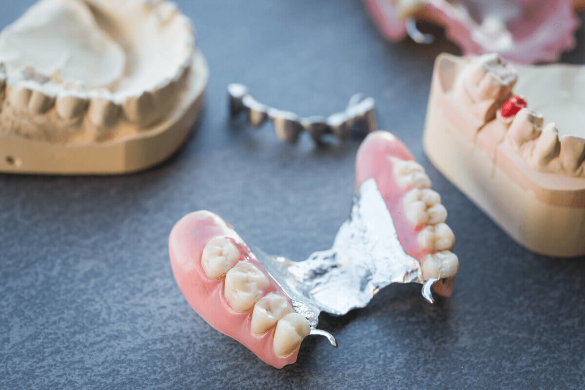 the pros and cons of dentures