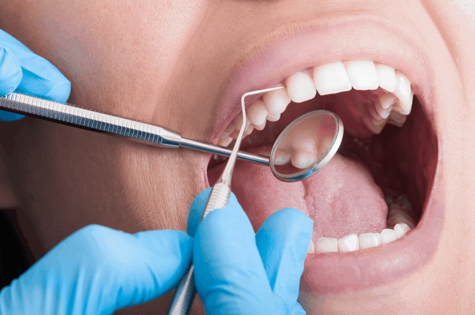 periodontal treatment in carrollwood