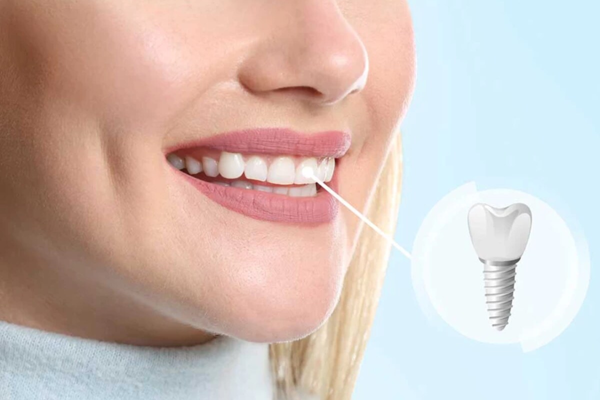 a bridge to confidence regain your smile with dental bridges